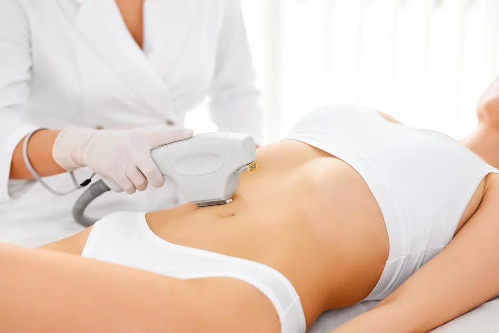 Laser Hair Removal in Orlando, FL | Apex Fit