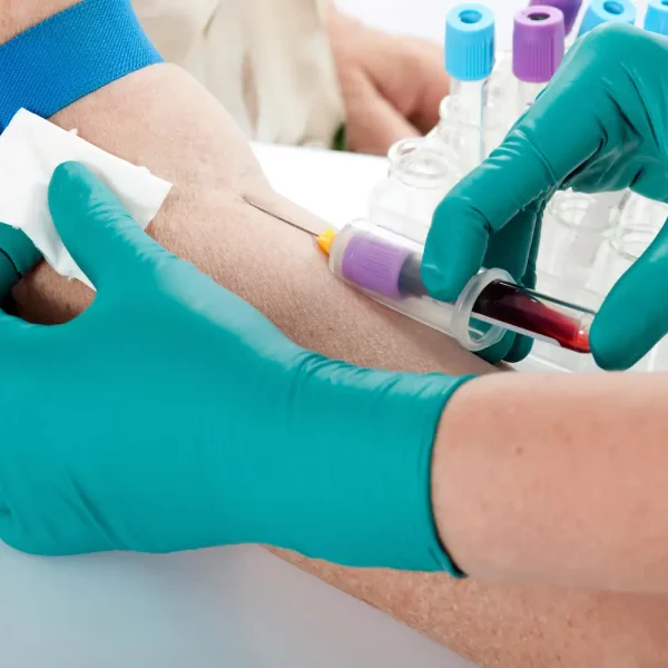 Taking a blood sample from a person's arm | Apex Fit in Orlando, FL