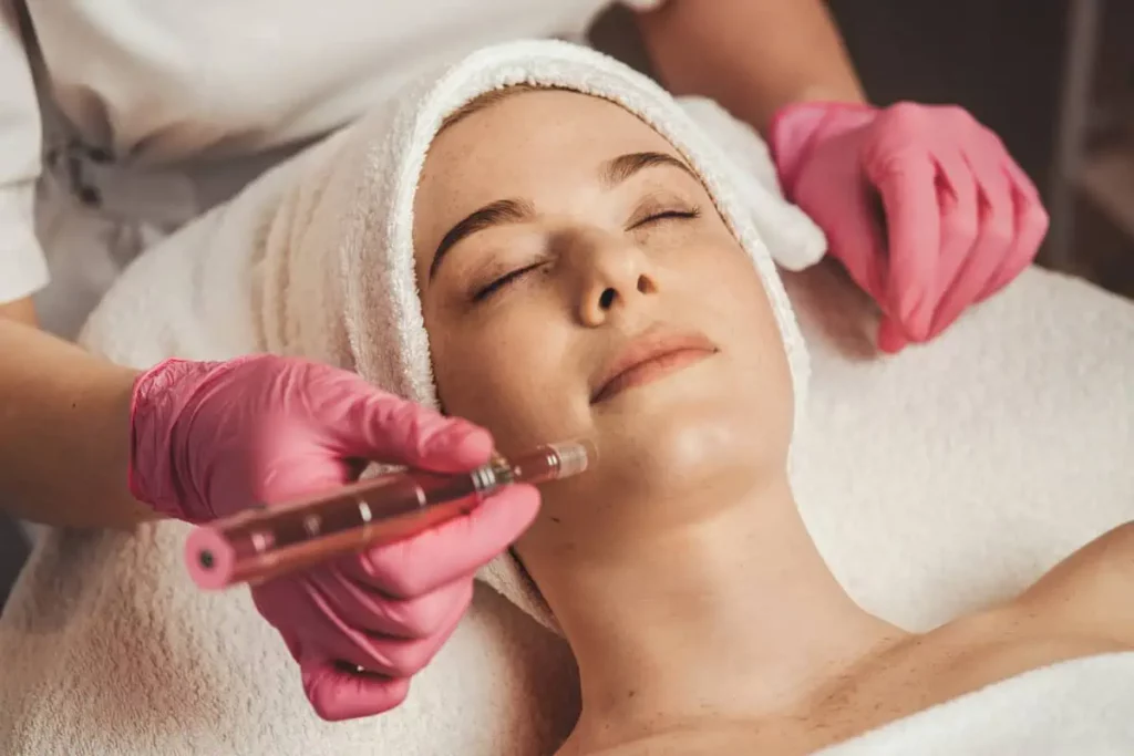 Microneedling by Apex Fit in Orlando, FL 